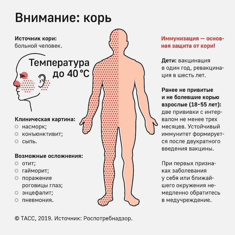 Корь. Профилактика.